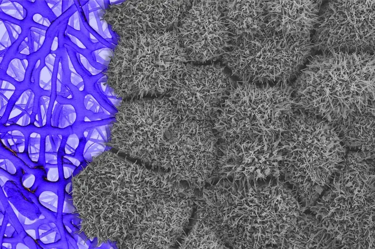 iPS細胞から作られた網膜色素上皮の組織を電子顕微鏡で撮影した画像。左側に青く着色された膜状の構造、右側に細かな突起で覆われた細胞が敷き詰められた様子が写っている。